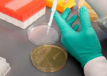 Scientist working with a pipette and petri dish 